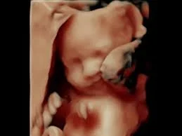 Fetus in the womb, showing detailed developmental features.