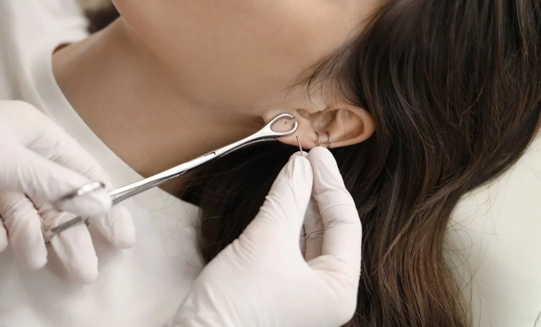 A person wearing gloves is using a curved tool to remove or examine jewelry or a piercing from a woman's ear.