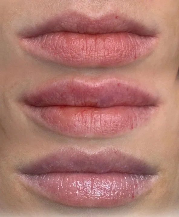 Close-up of three sets of human lips, showing different states of dryness and moisturization.