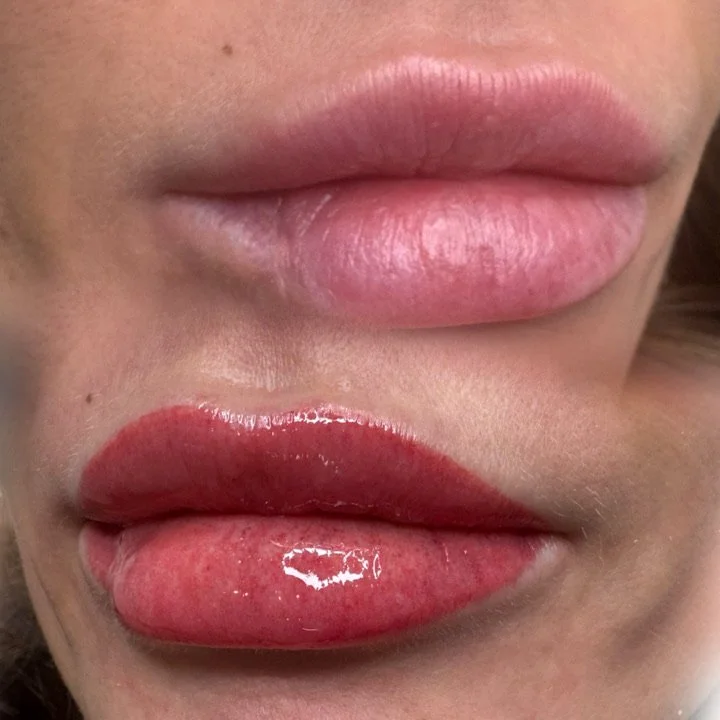 Close-up of a person's lips, with the upper lips appearing natural and the lower lips painted bright red with gloss, featuring a shiny reflection.