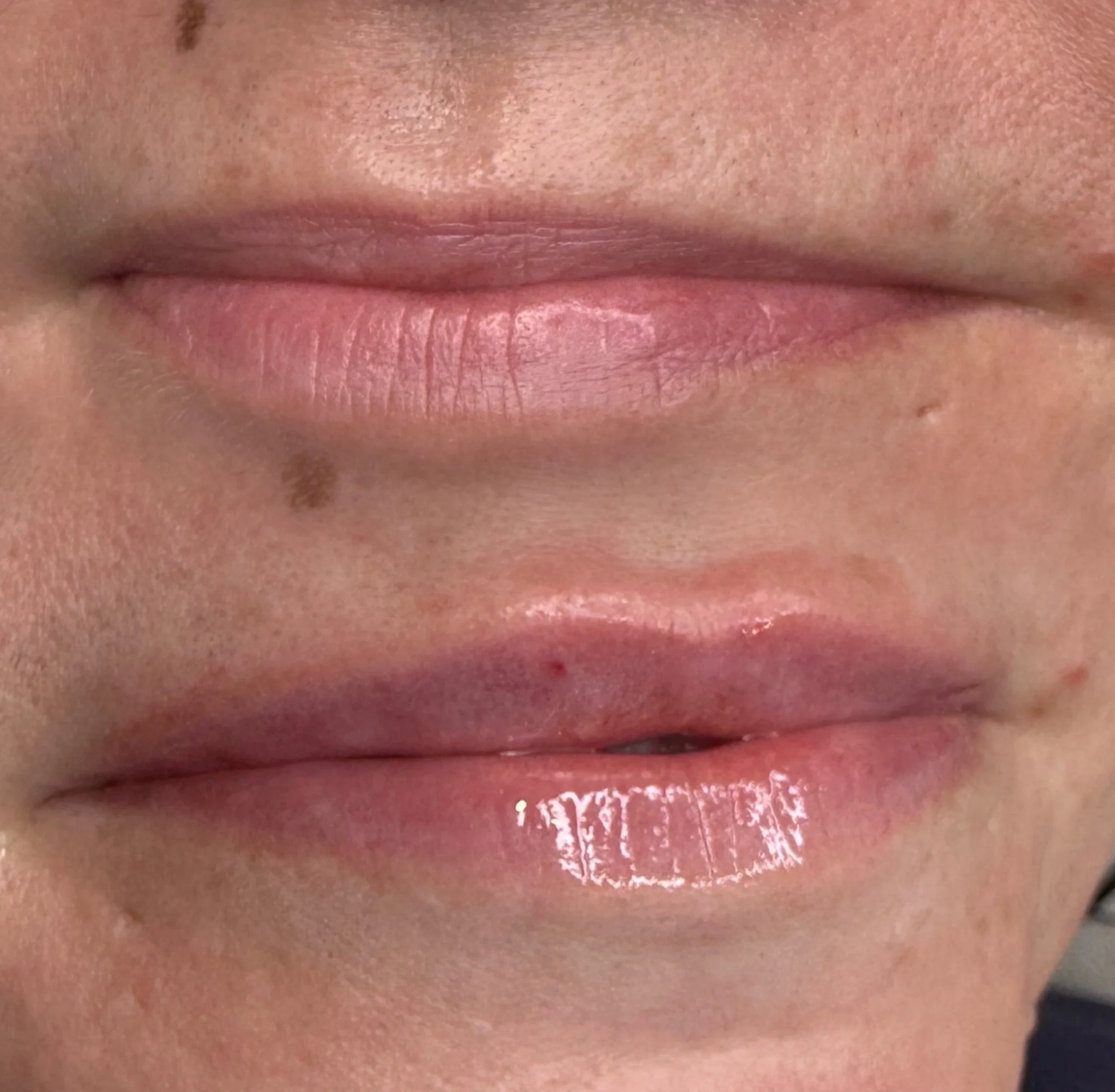 Close-up of a person's lips and surrounding skin, showing natural lip color, minor skin imperfections, and a small mole.