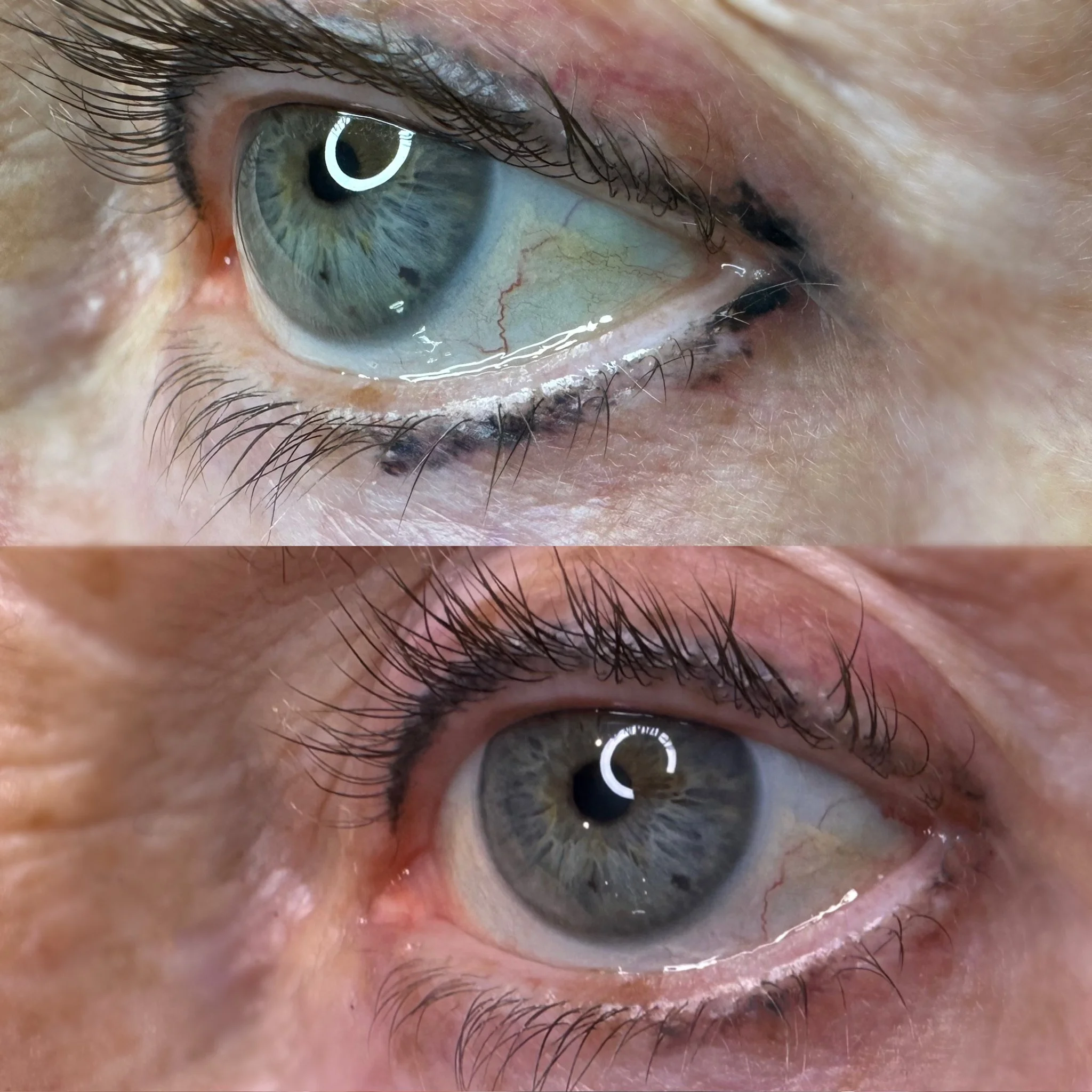 Close-up of a person's eye showing the iris, eyelashes, and surrounding skin, with a reflection of a ring-shaped light source in the eye.