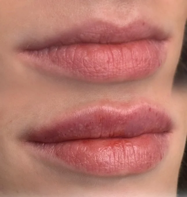 Close-up of two sets of lips, one above the other, showing natural skin and lip texture.