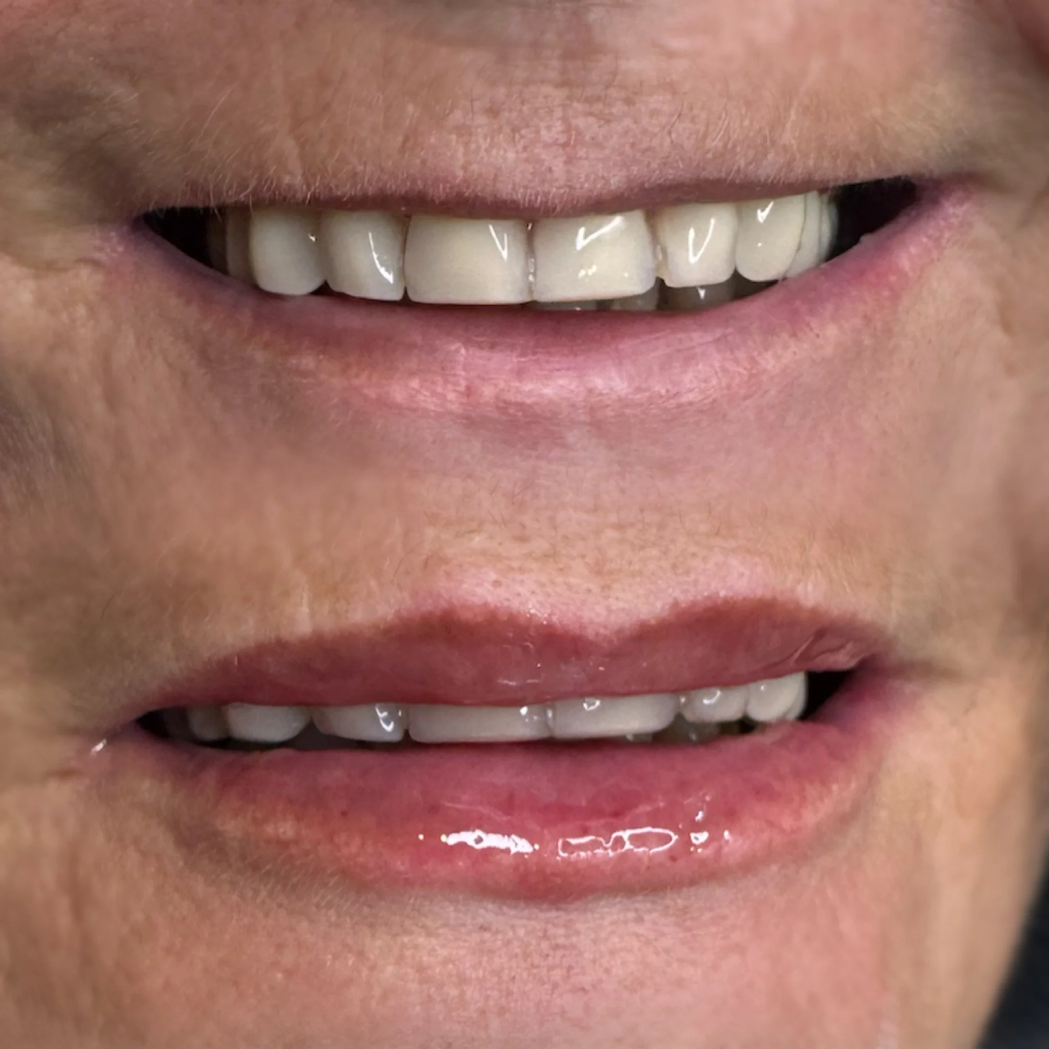 Close-up of a person's smiling face showing their teeth and lips.