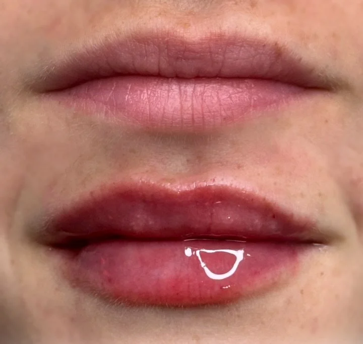 Close-up of a person's lips with a small amount of clear liquid on the lower lip.