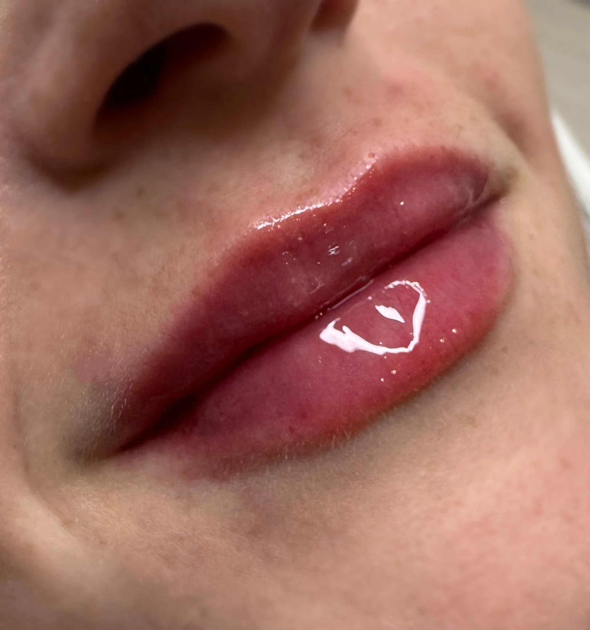 Close-up of lips with lip gloss and a small amount of saliva.