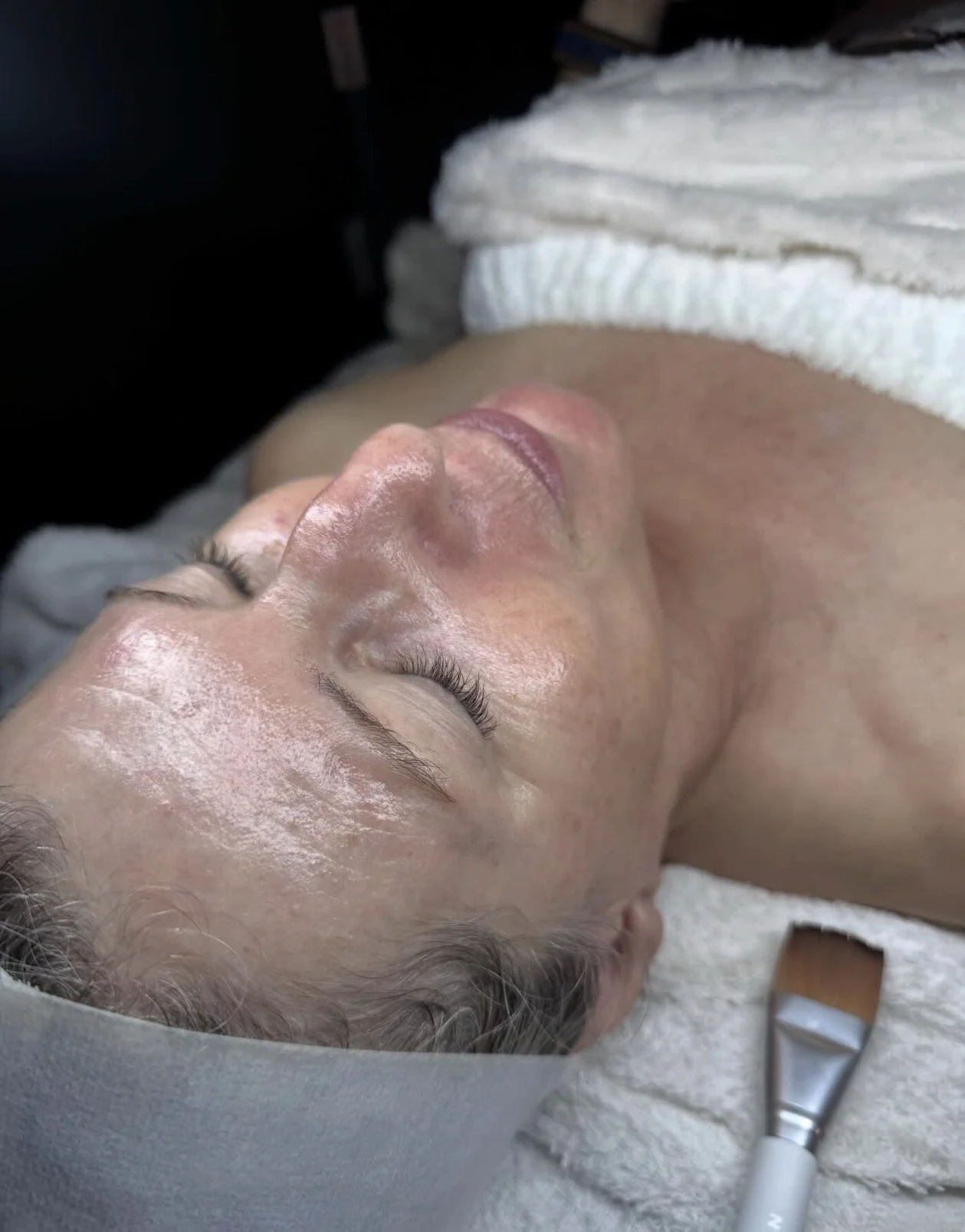 Advanced Skin Treatments