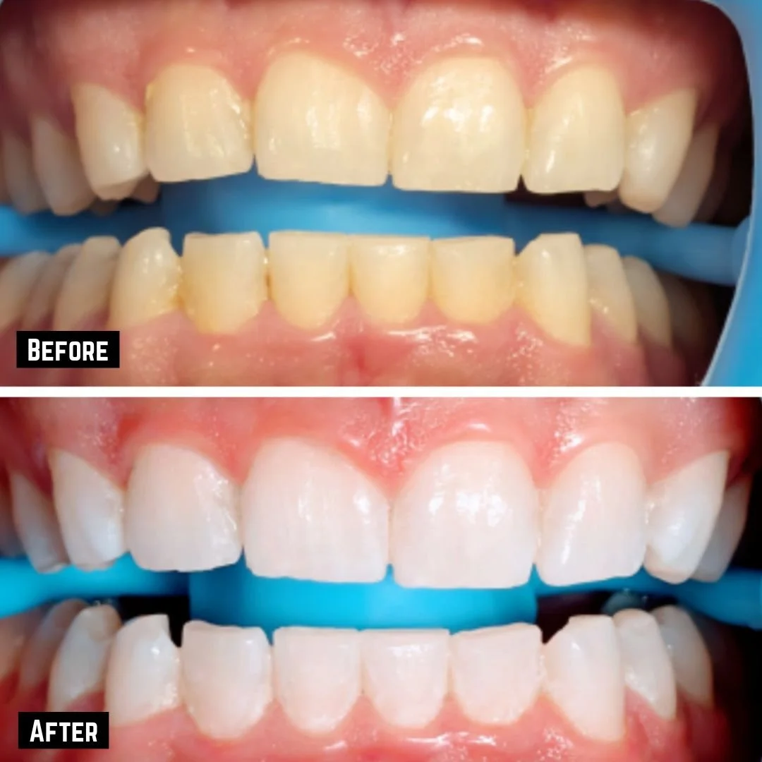 andre before and after no logo.jpg
