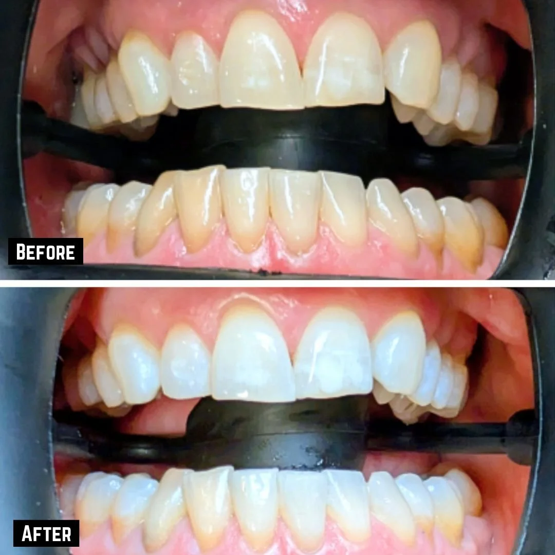 julie before and after no logo.jpg