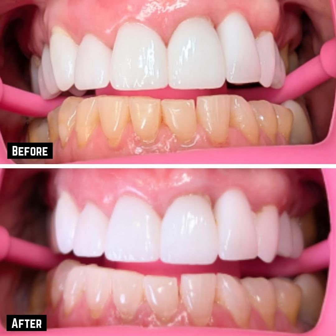 tracey before and after no logo.jpg