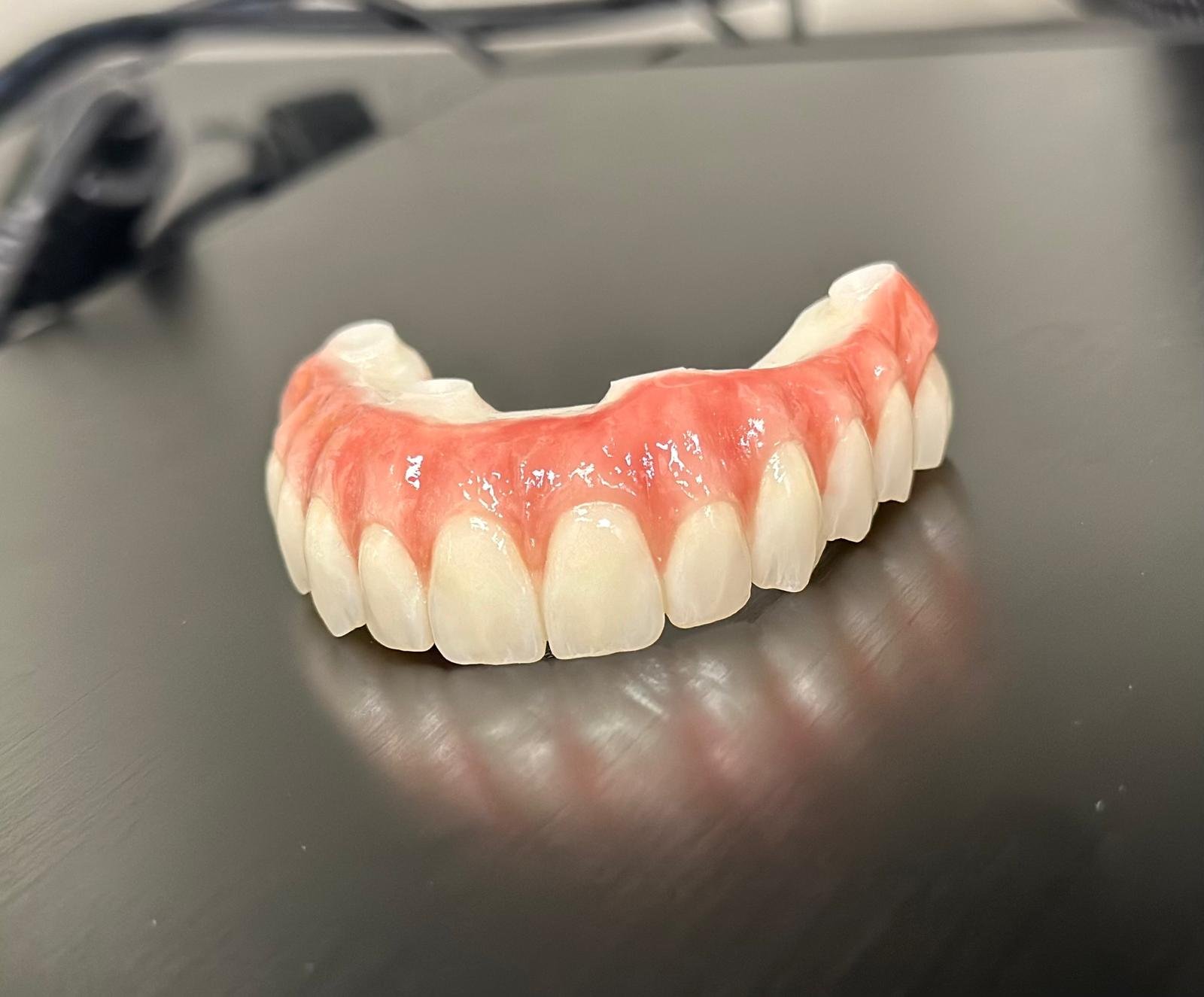 Full zirconia All-on-X full arch restoration by Funes Dental Lab