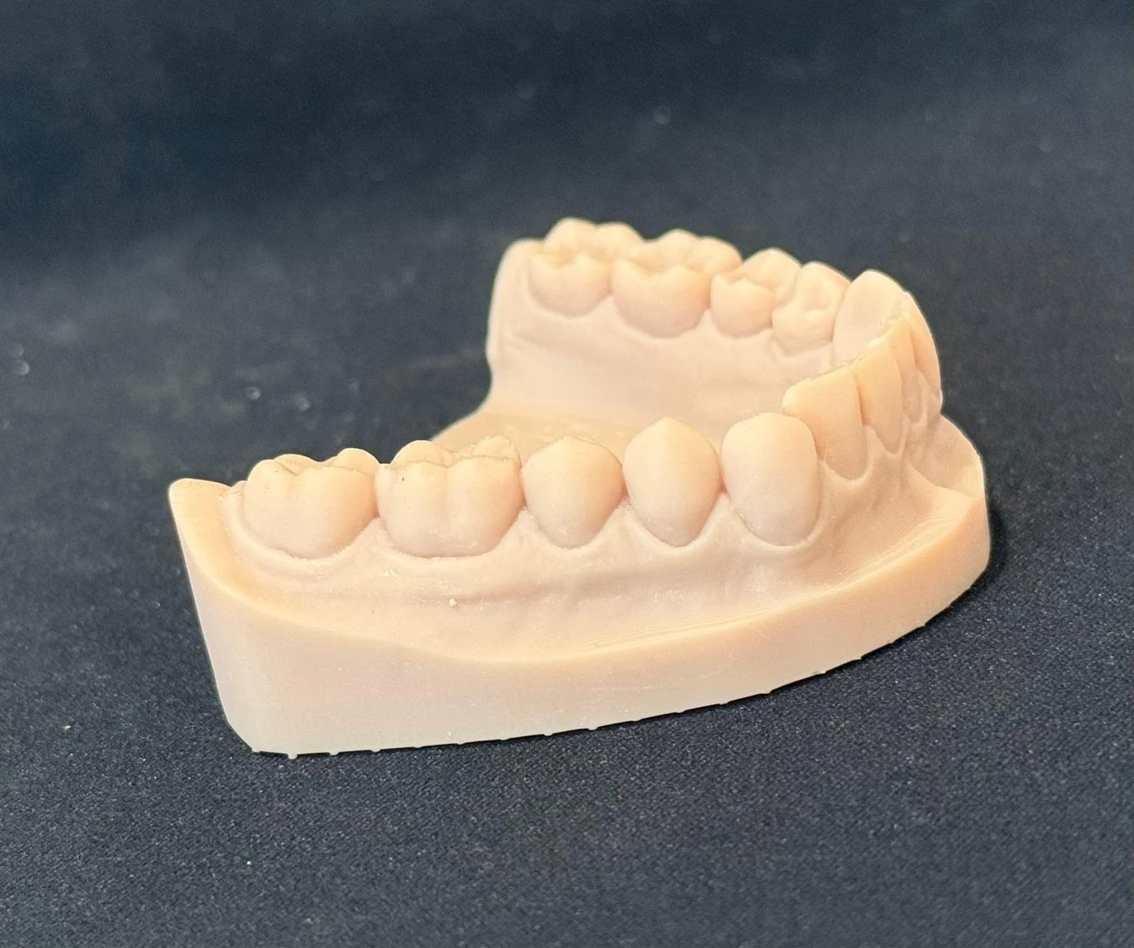 3D printed dental model for restorative workflow