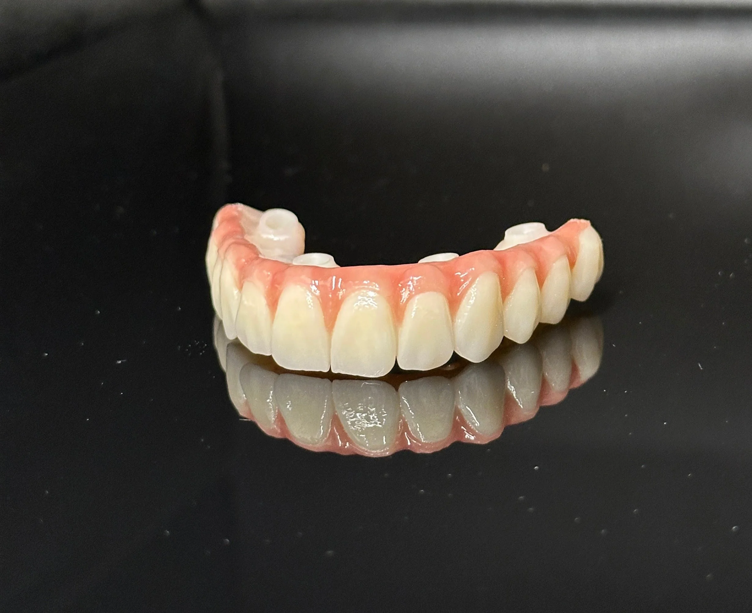 Full zirconia All-on-X full arch restoration by Funes Dental Lab