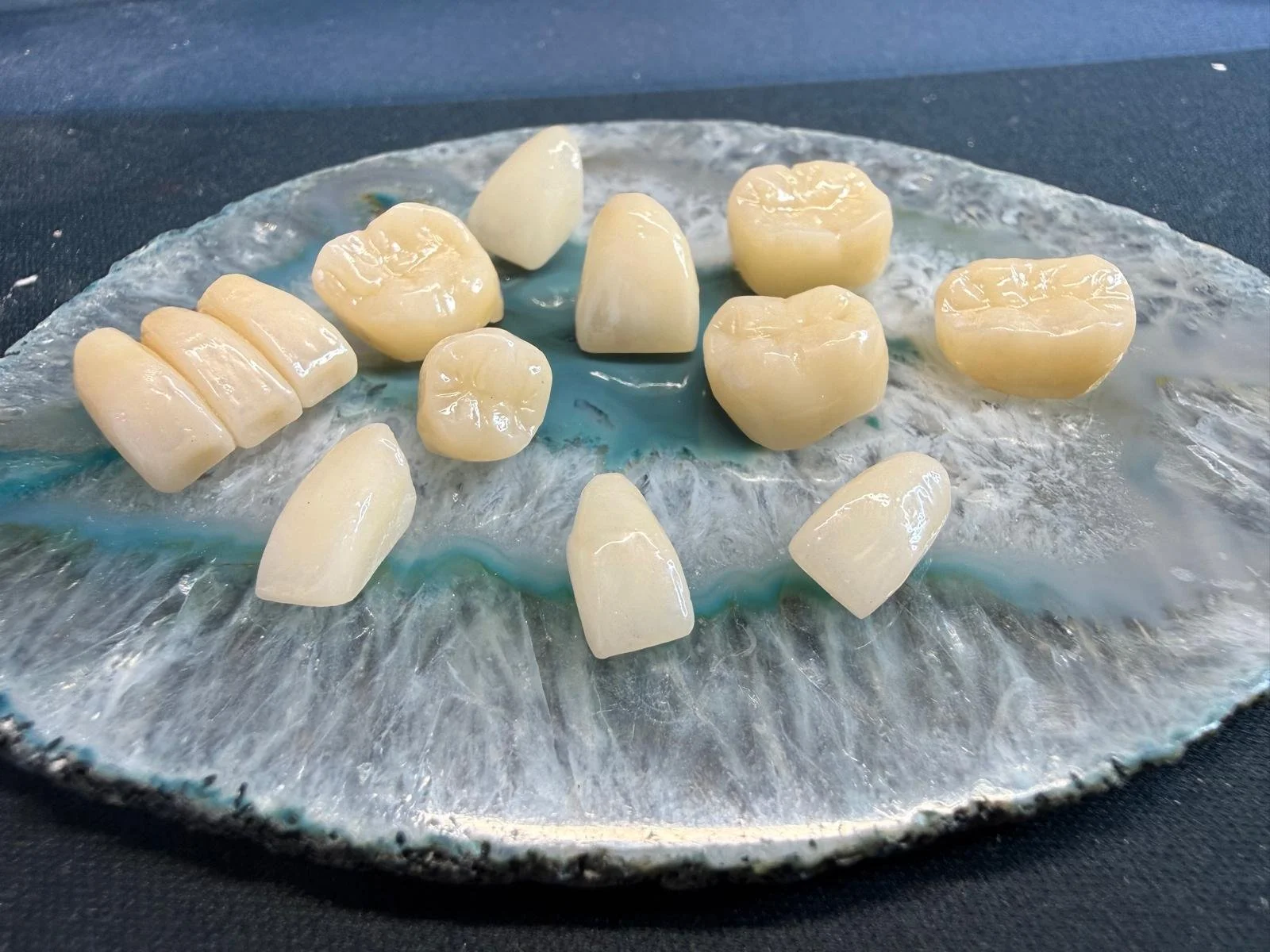 Zirconia crown and bridge restorations by Funes Dental Lab