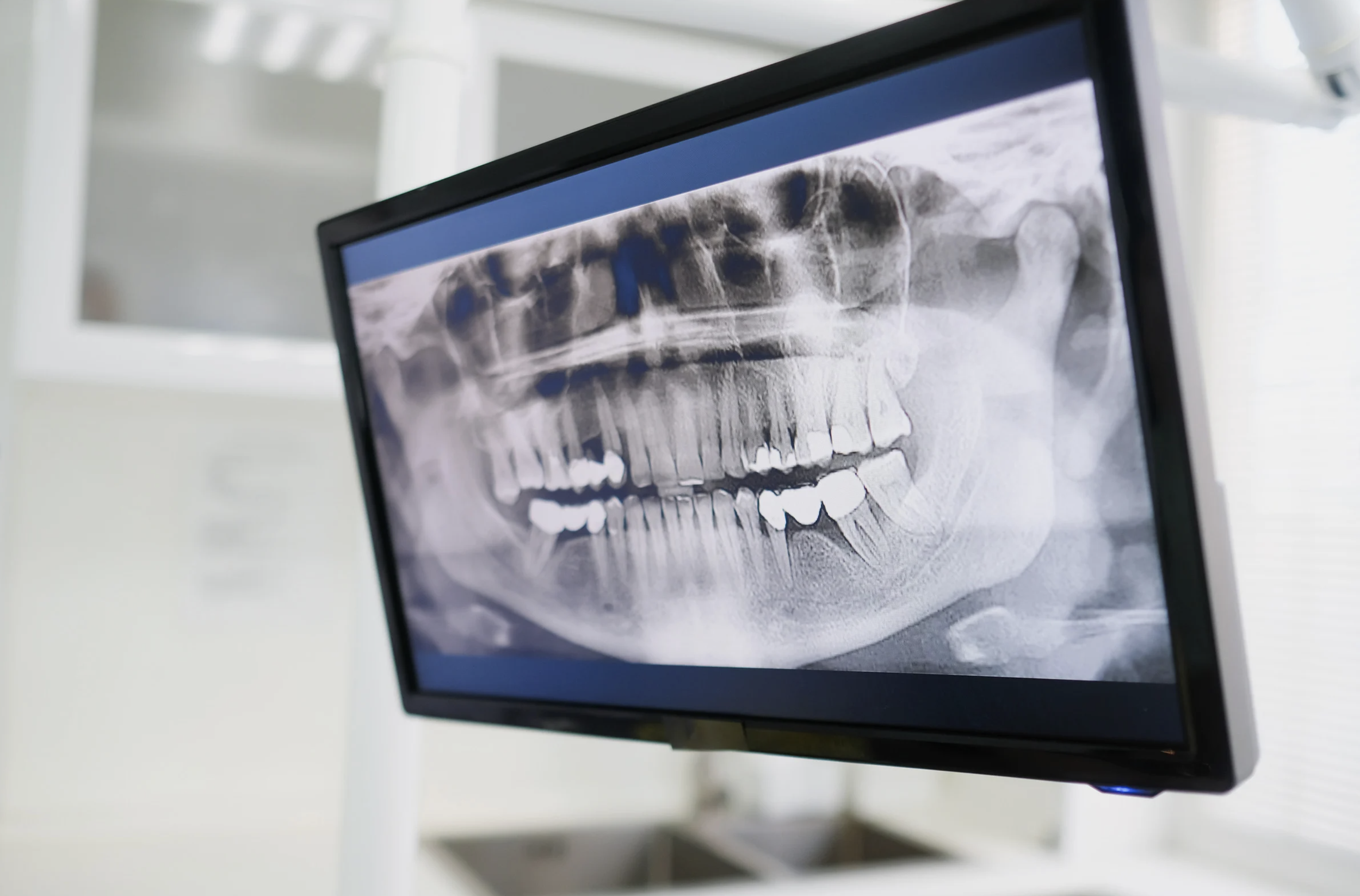 Screening Radiologico: Guardare Oltre la Superficie