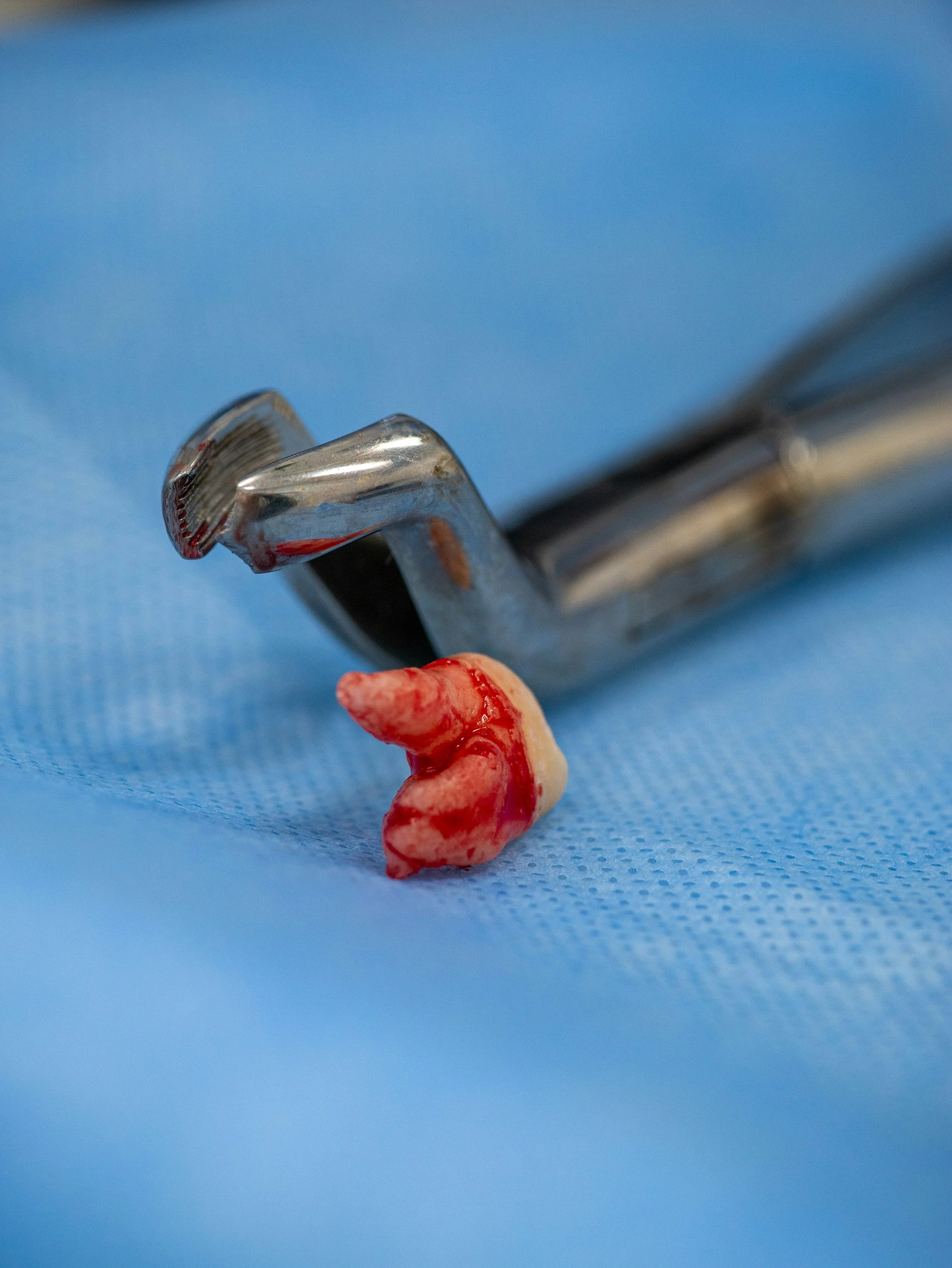 Chirurgia Orale e Implantologia: Ripristinare Funzione, Salute e Sorriso