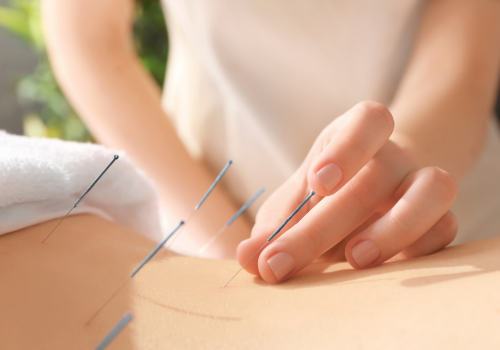 Person receiving acupuncture treatment with multiple acupuncture needles inserted into their back.