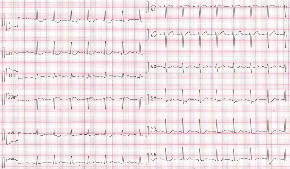 Aslanger Pattern — POST SHIFT PEARLS