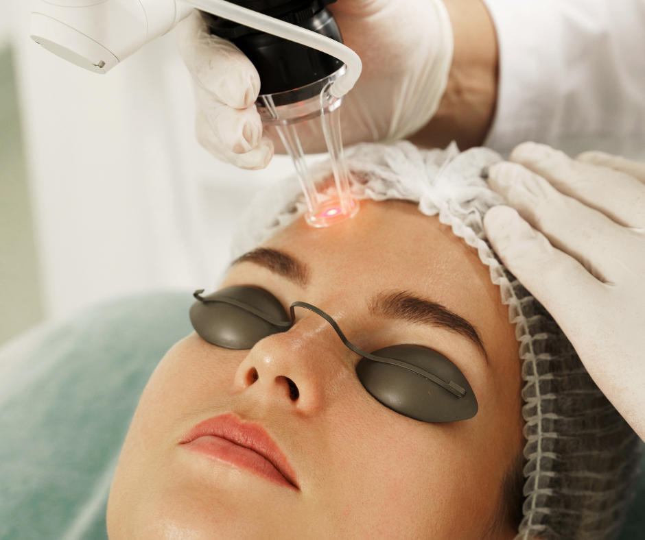 A woman receiving laser skin treatment on her forehead in a medical setting