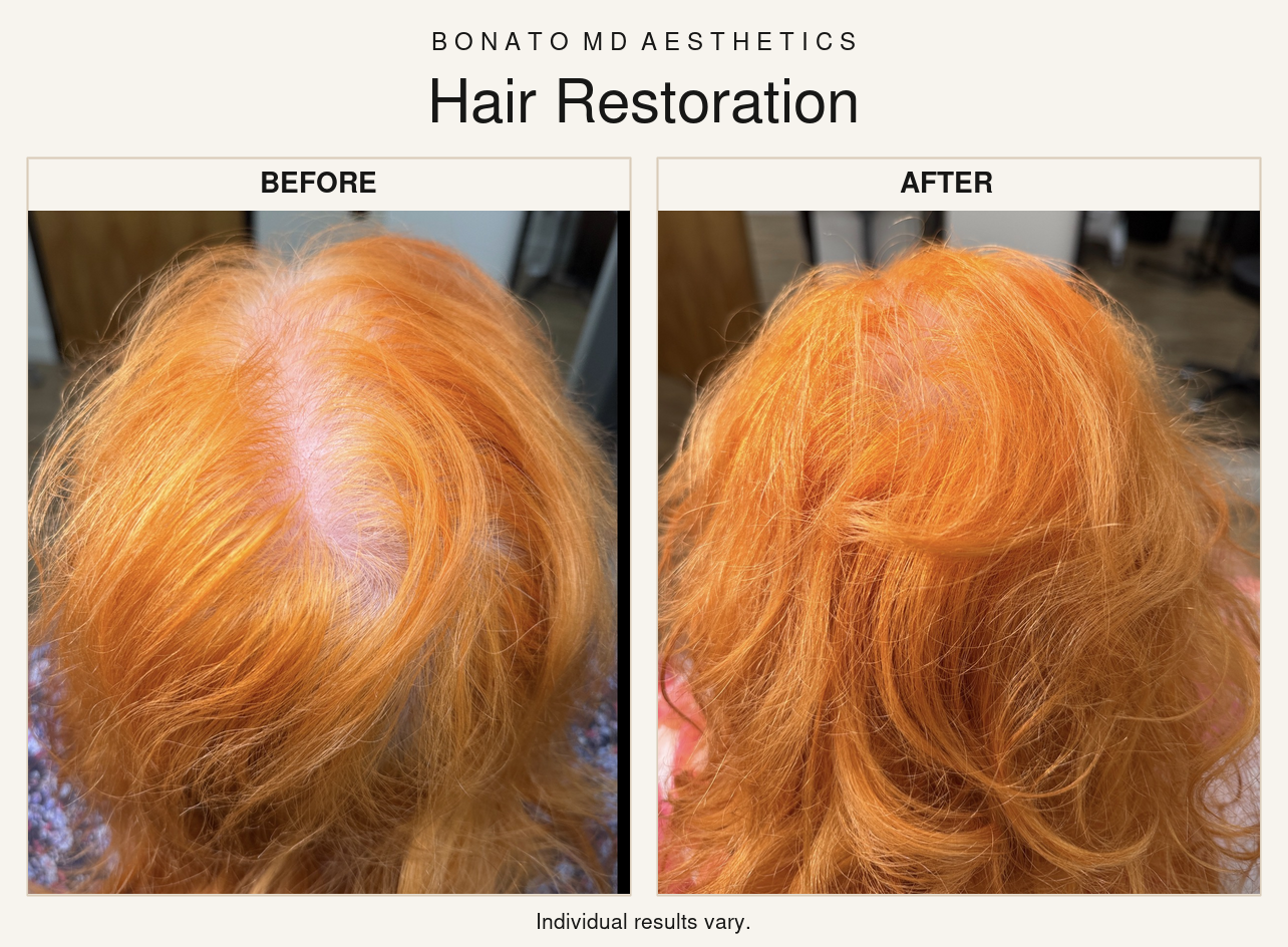 Dr. Bonato's patient — individual results vary