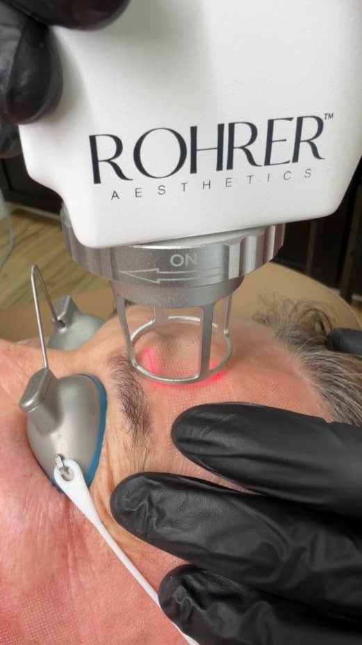 CO2 laser resurfacing Medford Oregon