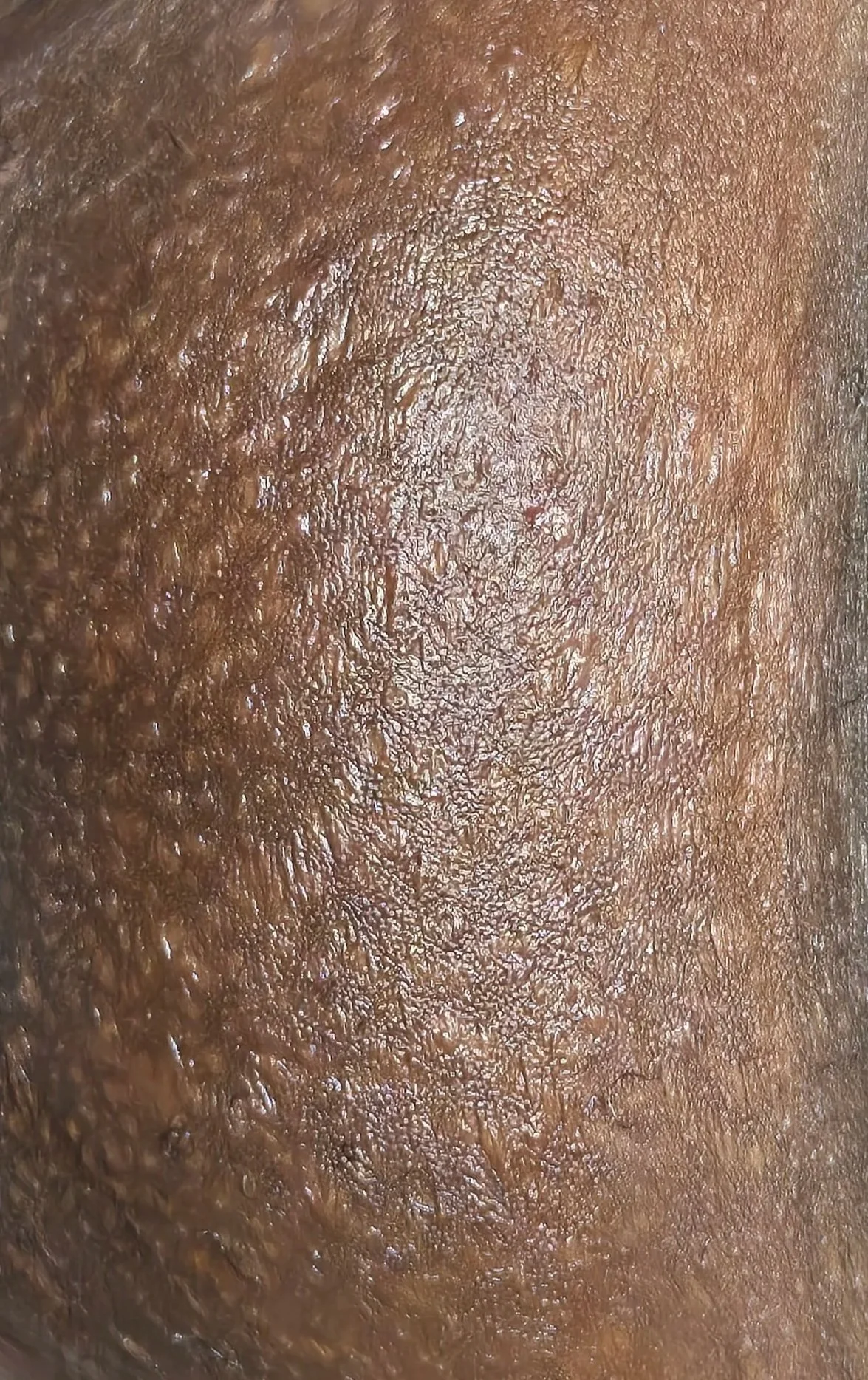 Butt Wax