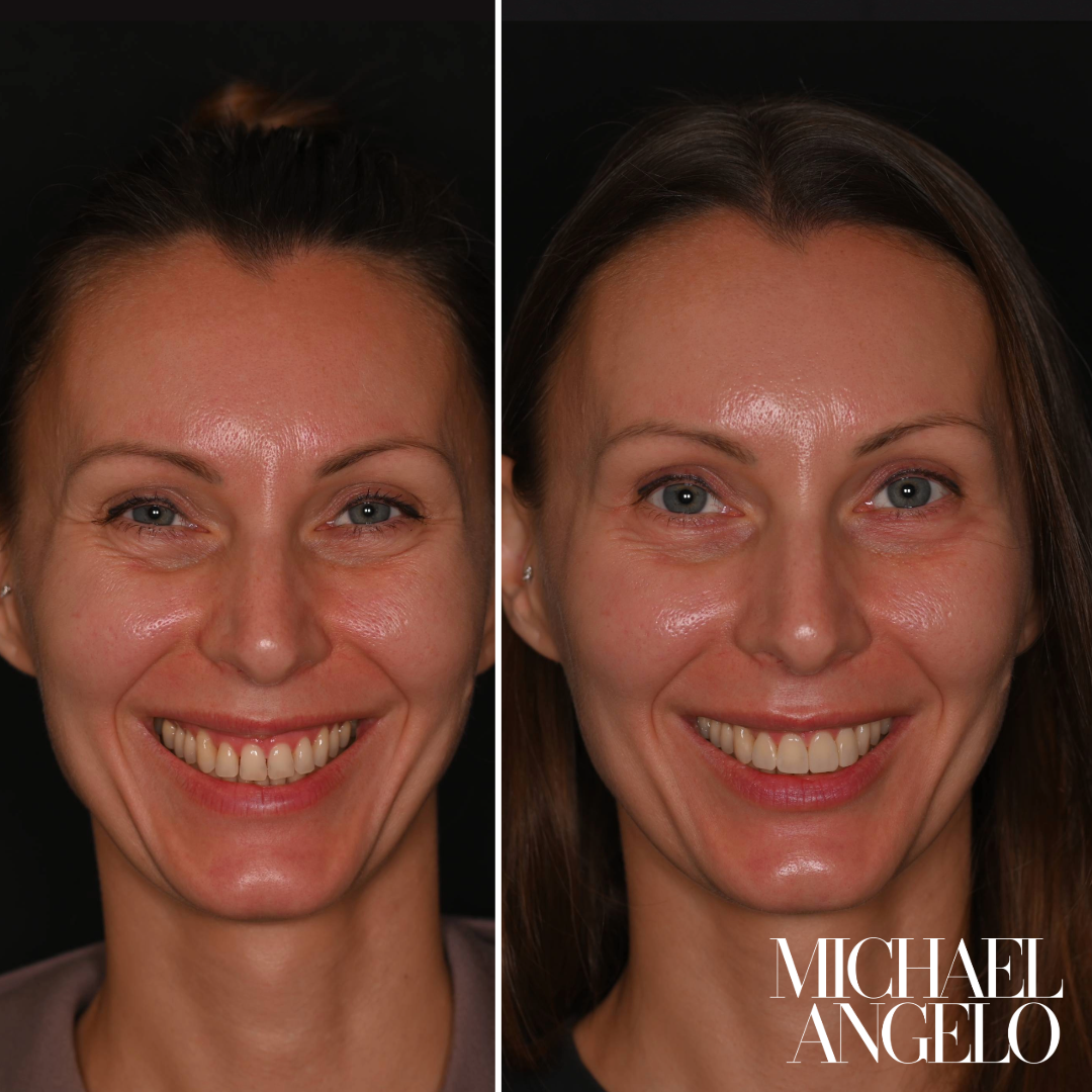 3. 090625 Svetlana_B&A_Face.png