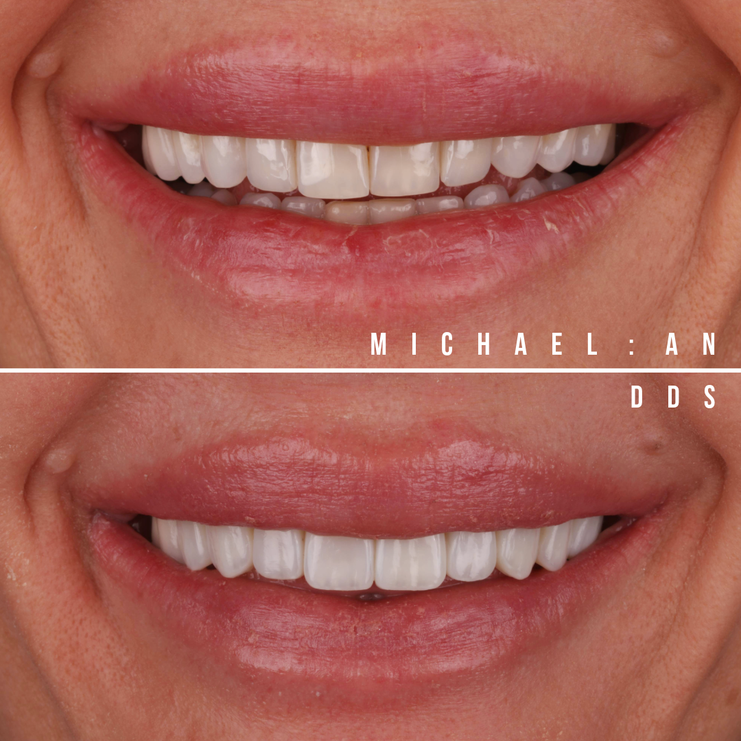 Cosmetic Consultation