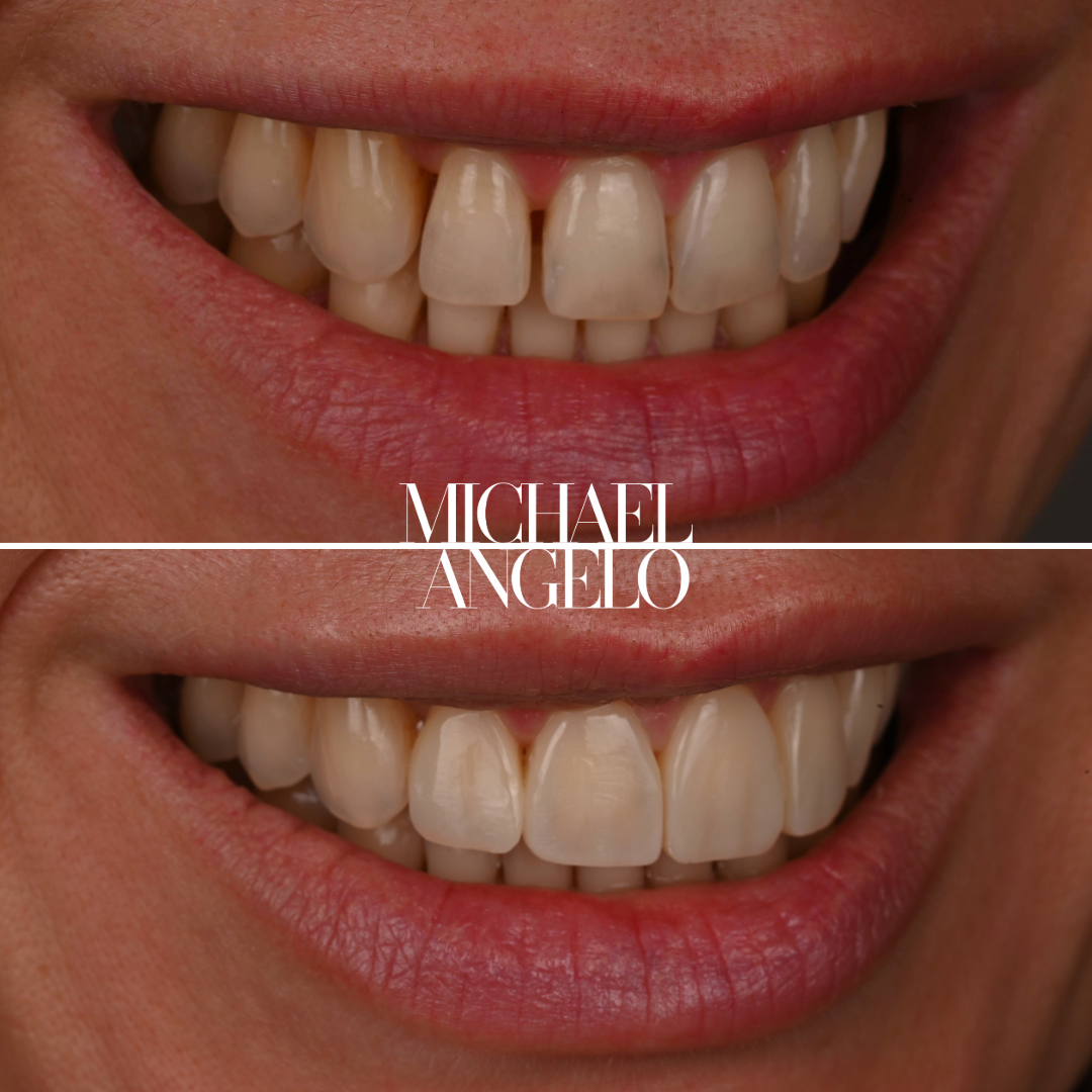 1. 090625 Svetlana_B&A_Lips.png