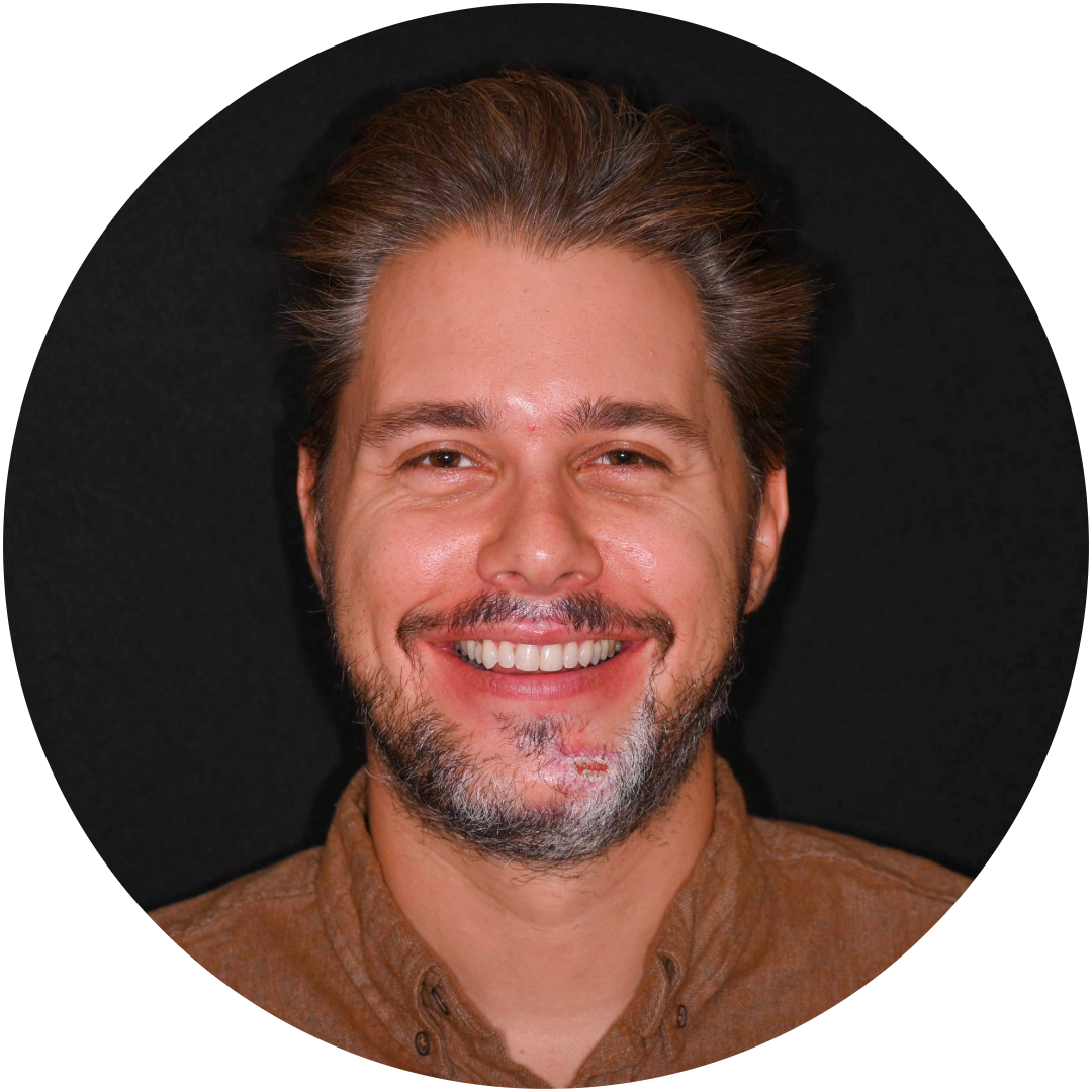 composite_veneers_andrei