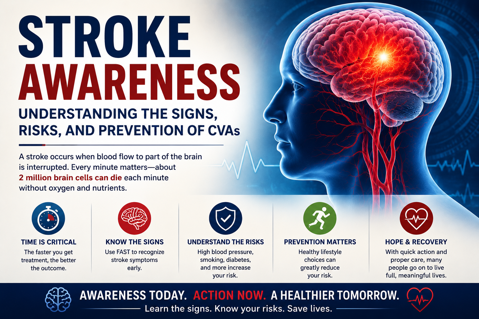 Stroke Awareness: Understanding the Signs, Risks, and Prevention of CVAs