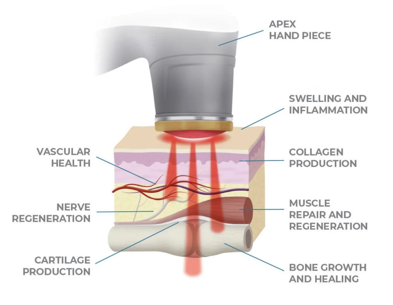 Diagram of a laser treatment on a joint showing the laser hitting swelling and inflammation, promoting collagen production, nerve regeneration, muscle repair, cartilage production, and bone growth.