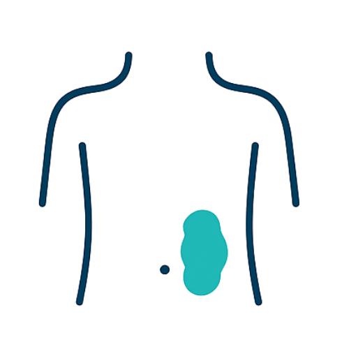 Hernia Surgery by Dr Smith. Simple illustration of a human torso with a blue highlighted area around the stomach.