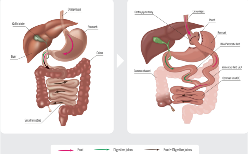 Diagram showing the process of digestion, illustrating the flow of food and digestive juices through the digestive system, including the stomach, small intestine, and liver.