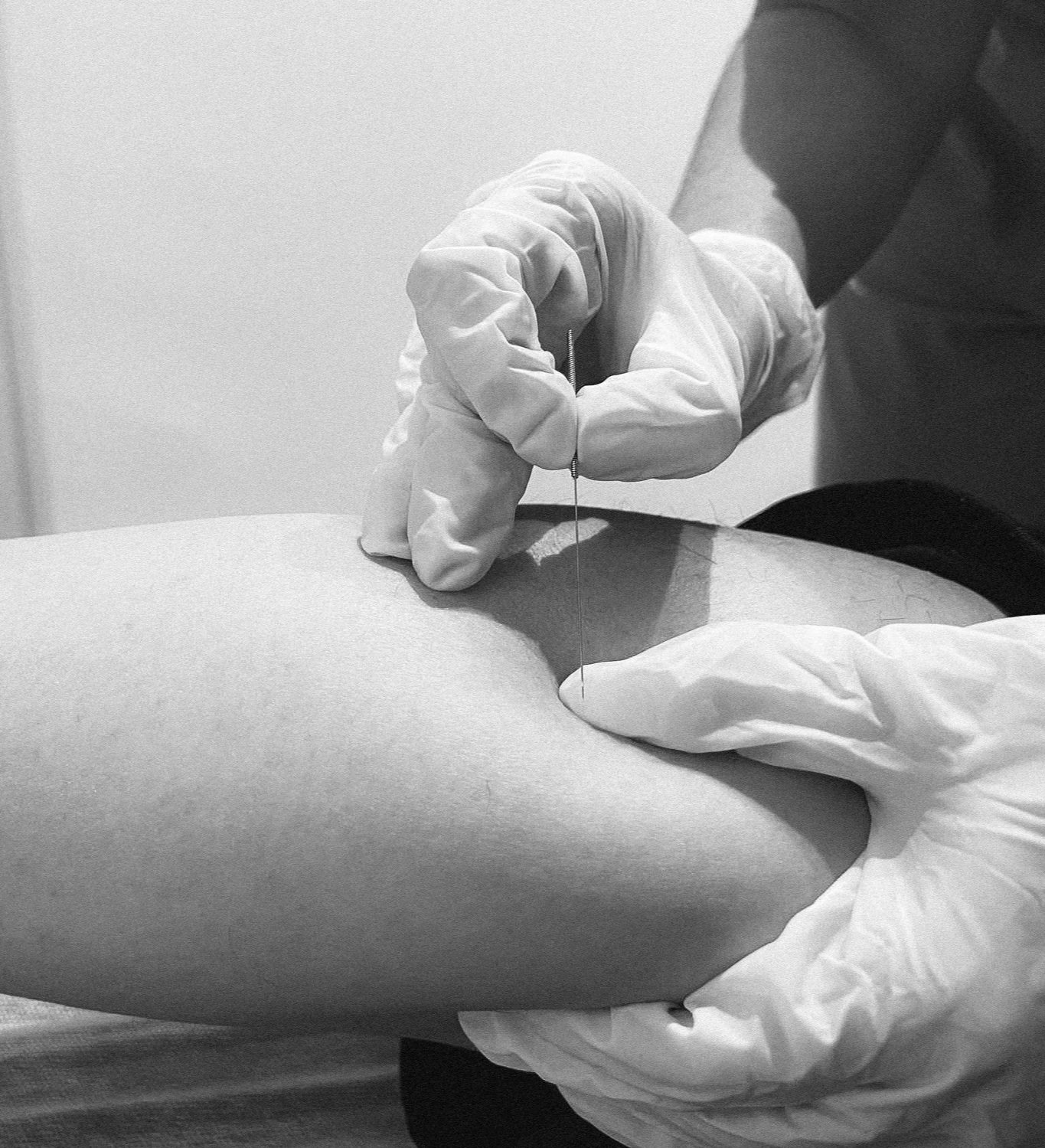 Persona administrando una inyección en el brazo de otra persona, ambas con guantes de látex.