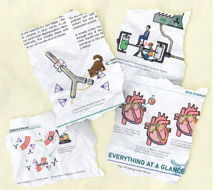 Collage of visual ECG analogies from the book 'ECG in the Pocket,' featuring the power plant model for cardiac conduction, bundle branch blocks illustrated as mechanical junctions, and intuitive diagrams for WPW syndrome.