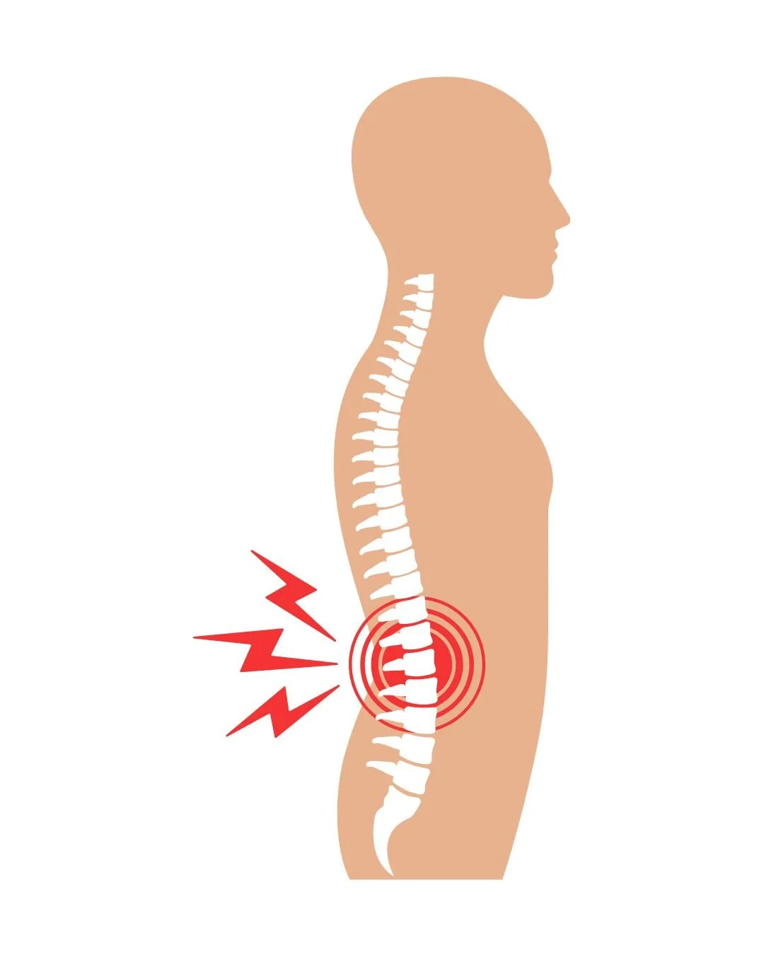Back &amp; Neck Pain