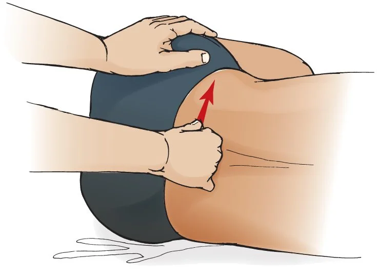 Illustration of a person performing a medical maneuver on a patient's buttocks, possibly a healthcare procedure or exercise.