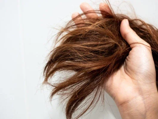 Why Is My Hair So Dry? 8 Common Causes &amp; How to Fix It