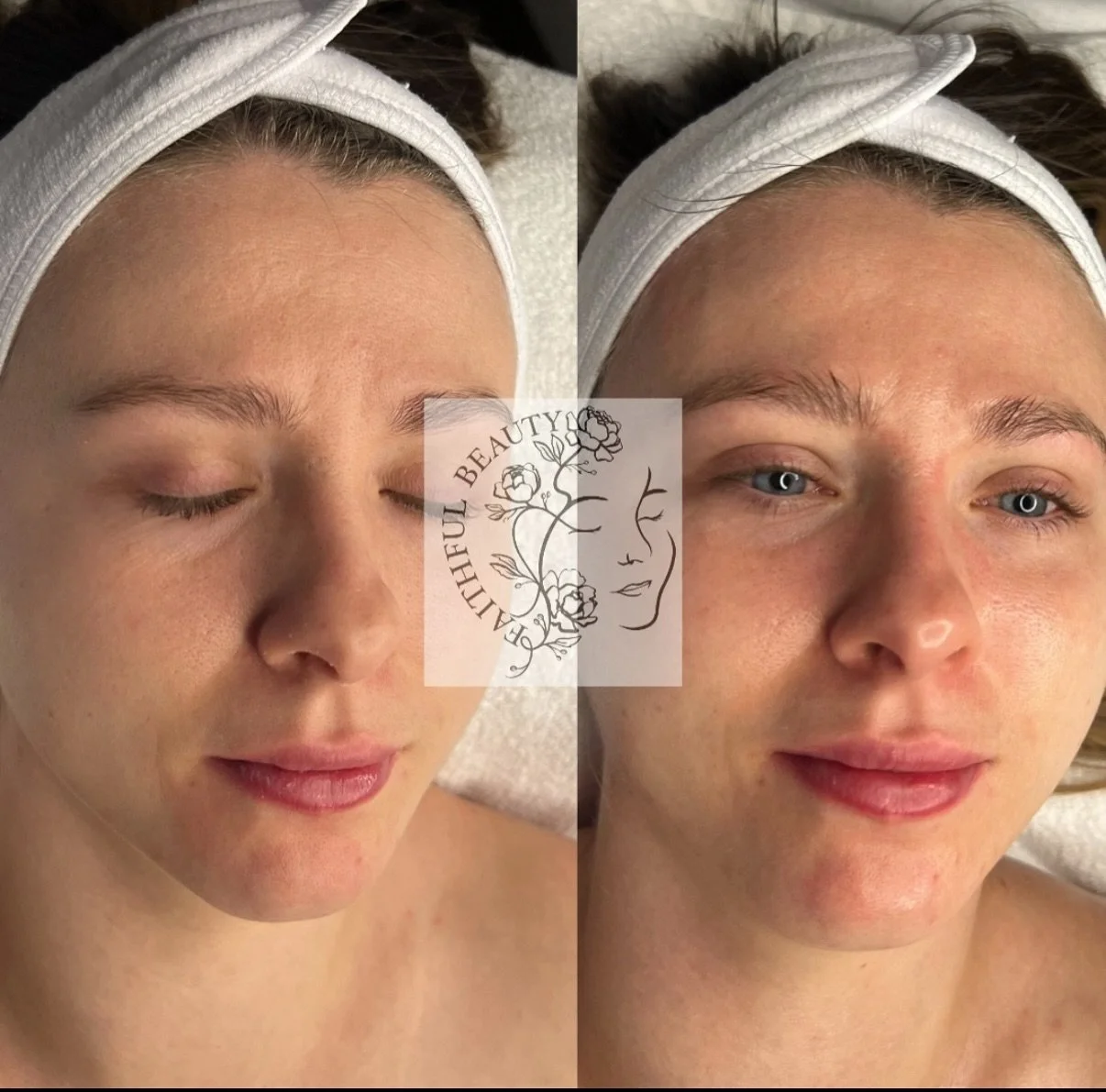 From tired to timeless ✨
Healthy, hydrated, glowing skin after a customized facial treatment.
Your glow journey starts here &mdash; book your next appointment today 💖
Glow season is every season ✨

Book your appointment 
📞 519-320-6650 call or text