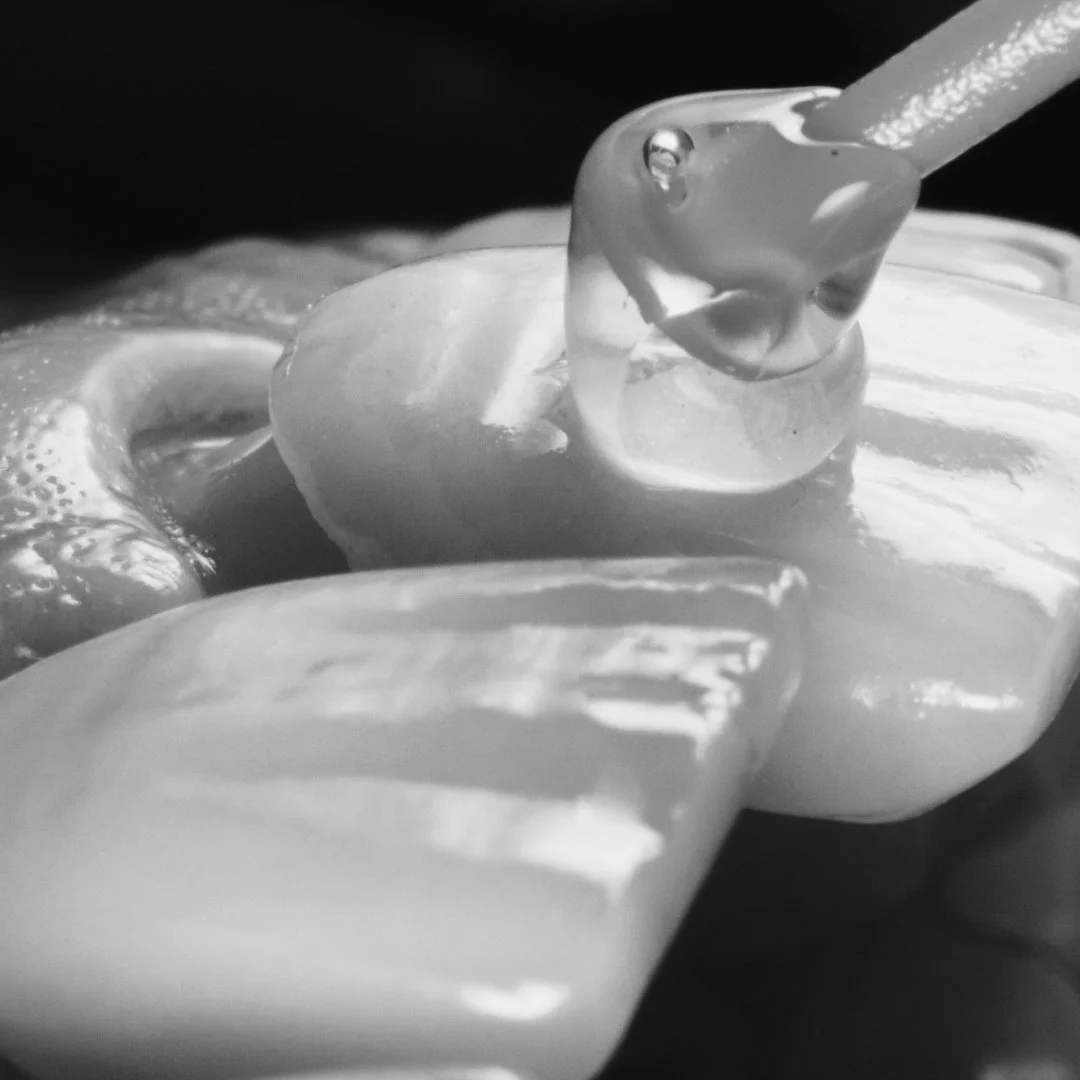 Porcelain veneers🌟