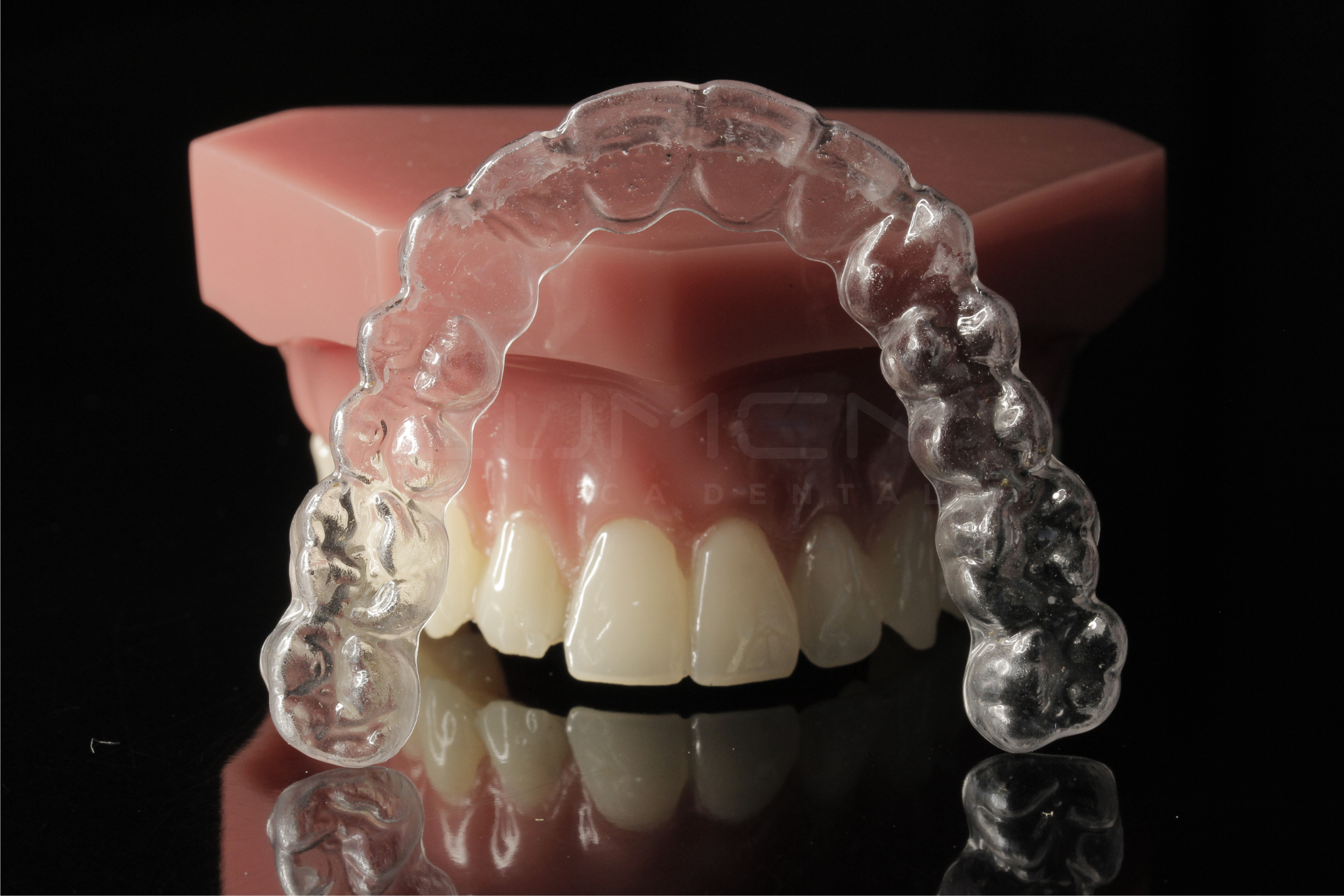 Brackets/ alineadores invisibles