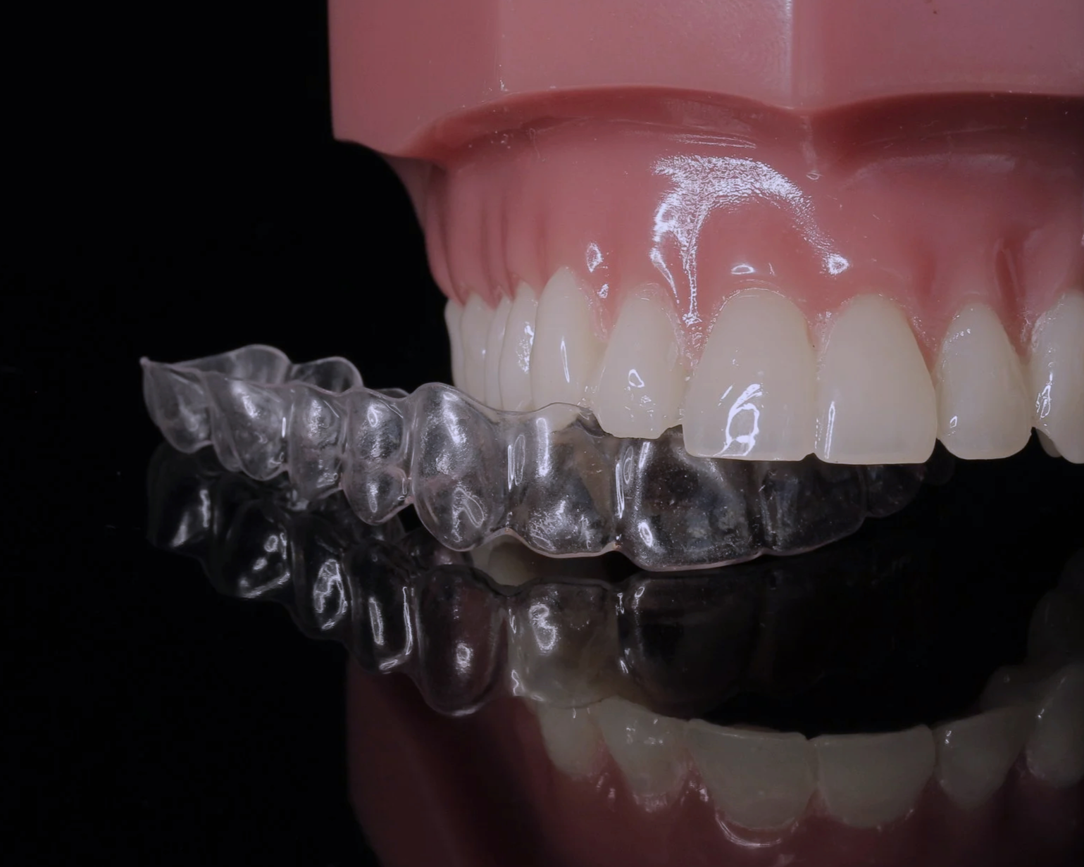 Ortodoncia/ Aligners