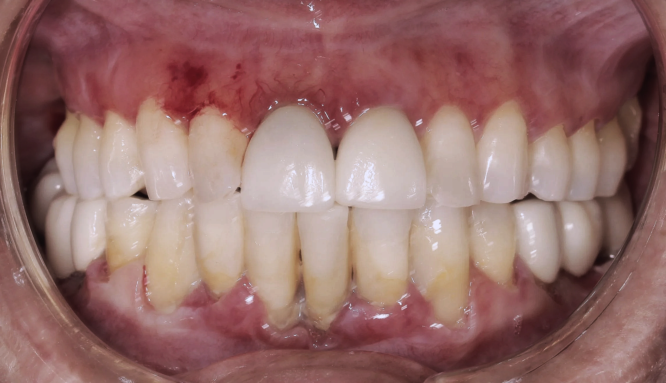 Periodoncia
