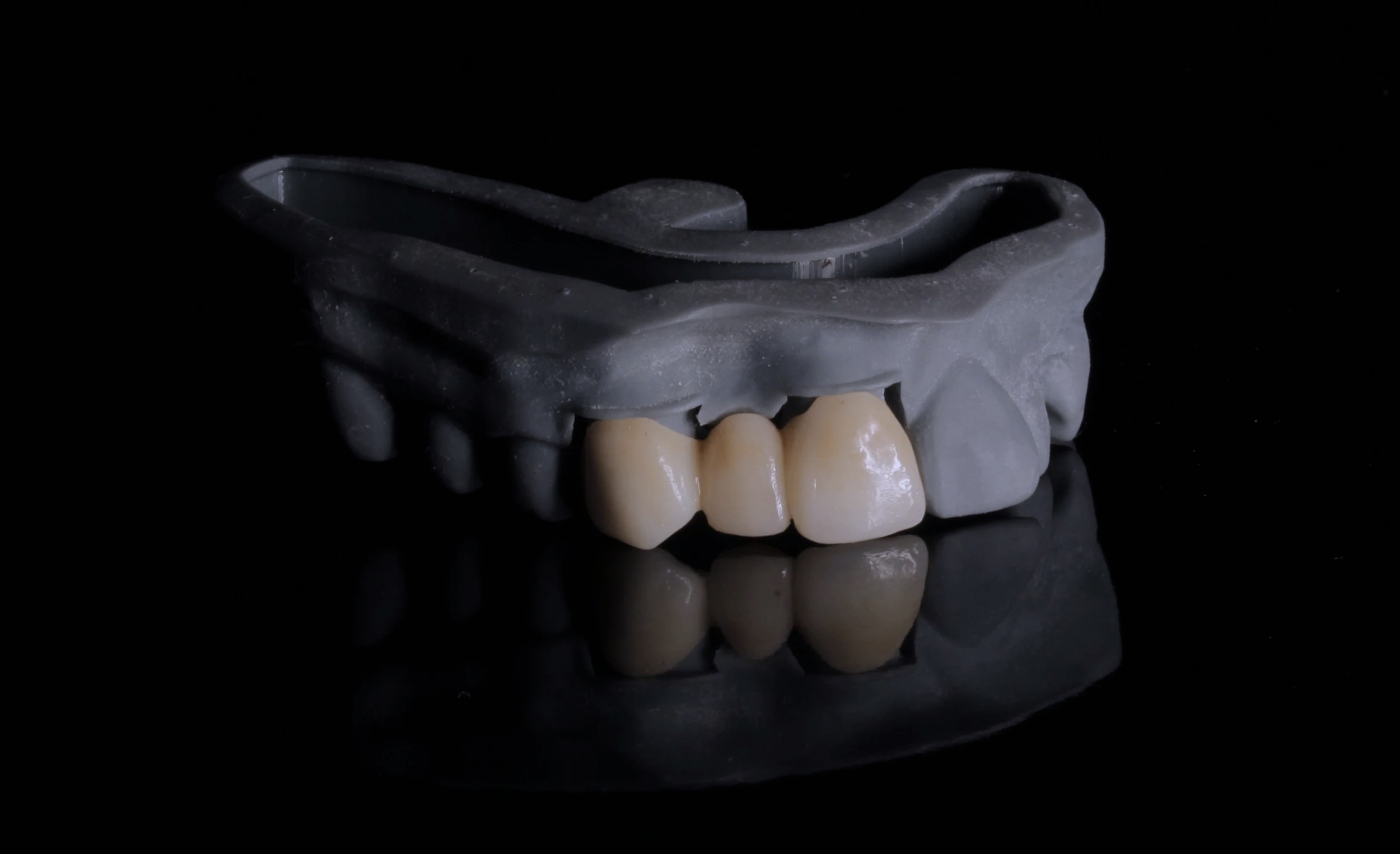 Prótesis dental - Oral Rehabilitation