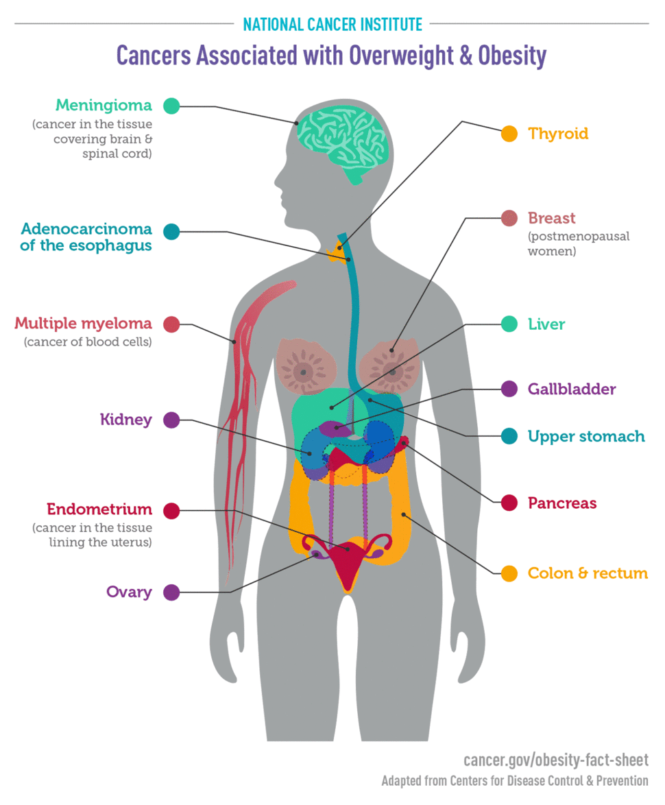 Diagram showing various cancers linked to overweight and obesity, including meningioma, adenocarcinoma of the esophagus, multiple myeloma, kidney, endometrium, ovary, thyroid, breast, liver, gallbladder, upper stomach, pancreas, and colon & rectum.
