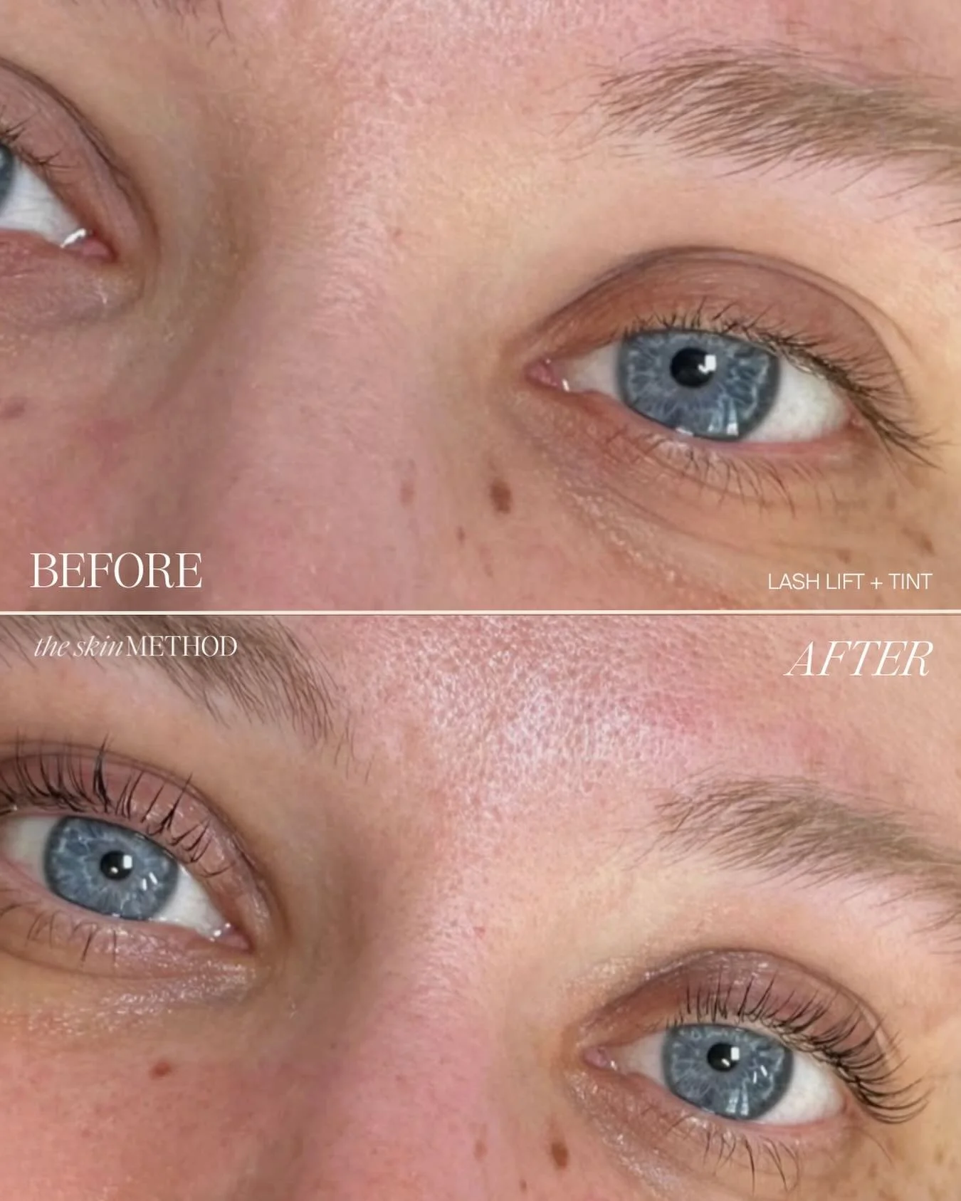 Before &amp; after by Gabby 🖤 This month, recieve a complimentary tint when you book your lash lift!

#licensedesthetician #skinhealth #glowingskin #correctiveskincare #skinconfidence
