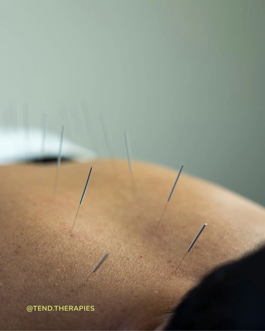 On Wednesday&rsquo;s I offer acupuncture and bodywork from @busselton_ahh . Reach out if you live in Busselton or surrounds and are looking for support with:

🎯 acute or chronic pain conditions
🩸 menstrual issues, peri/menopause or fertility
💨 gas
