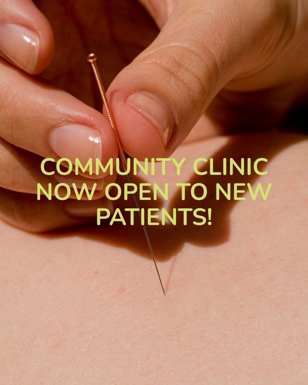 ☯️ Community Clinic @margaret_river_acupuncture is Now Open to New Patients! ☯️ 

Community Acupuncture makes it possible for more people to access regular treatments, even if finances are a barrier. For the last 6 months I've only been offering retu