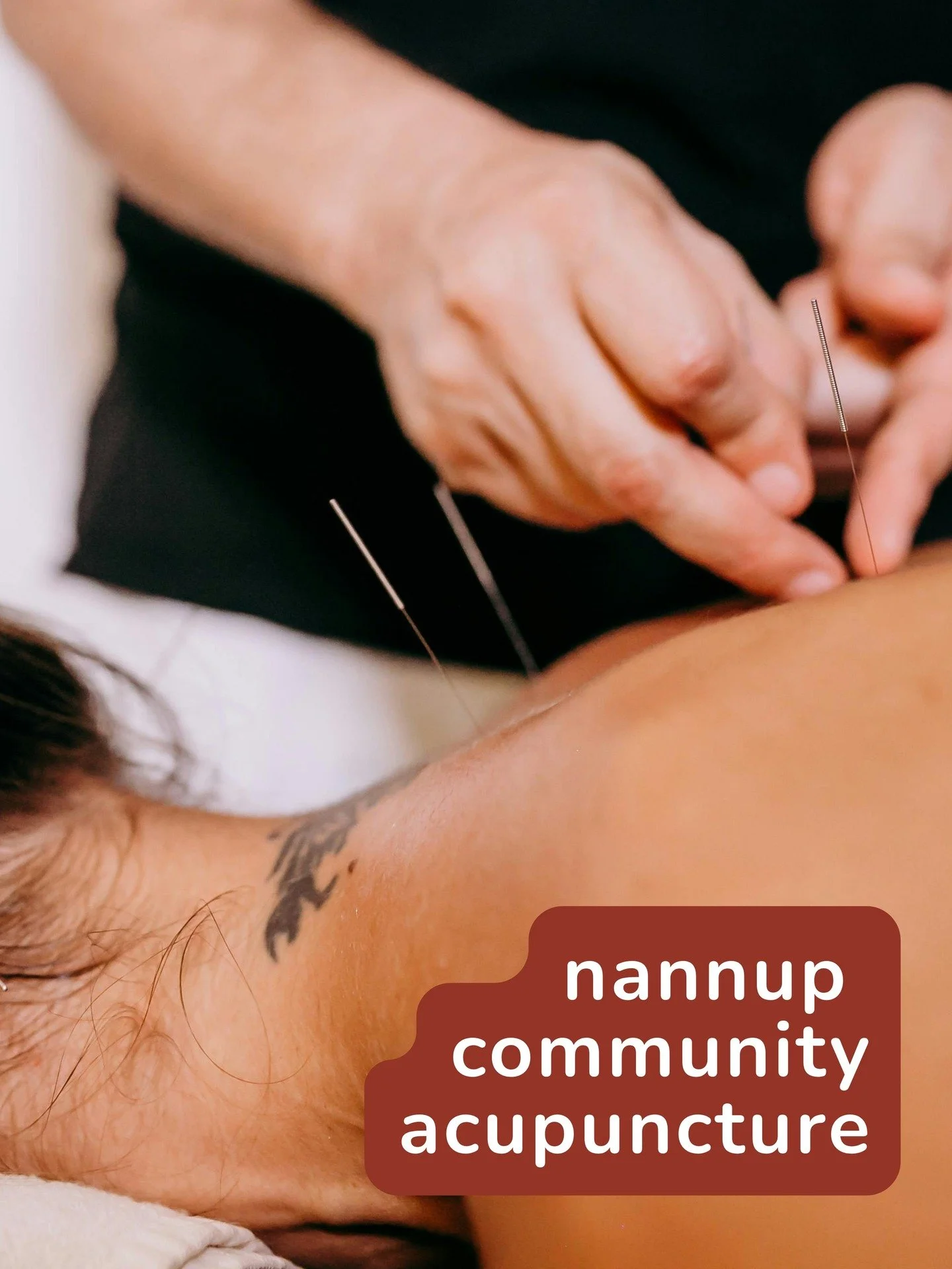 Do you have mates in Nannup? Think they might be keen for some acupuncture? Please send them this 🙌🏼

As some of you know, my partner and I have just bought and moved into our first home! Now the dust has settled and the boxes are unpacked, I'm kee